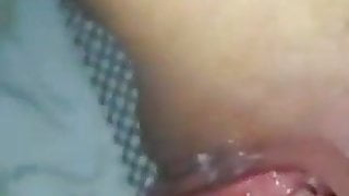 anal